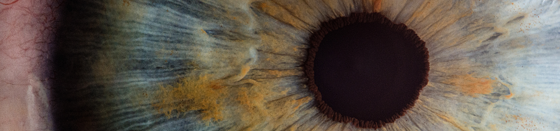 Auge Banner
